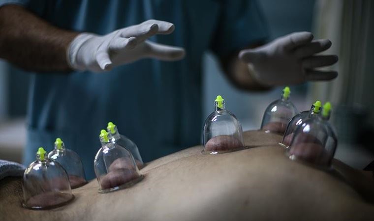 علاج الحجامة (مجالات الاستخدام الشائعة)