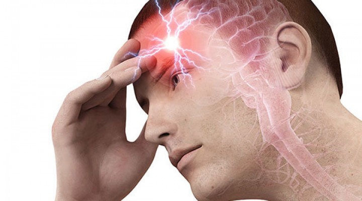 Headaches