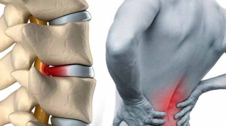 Lower Back Strain