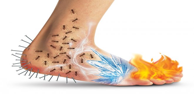 Neuropathic Pain Treatments